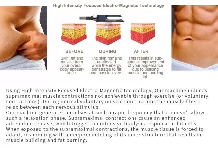 New Technology RF Function 2022 New Sculpt Fat Removal Build Muscle Slimming System EMS Body Sculpting