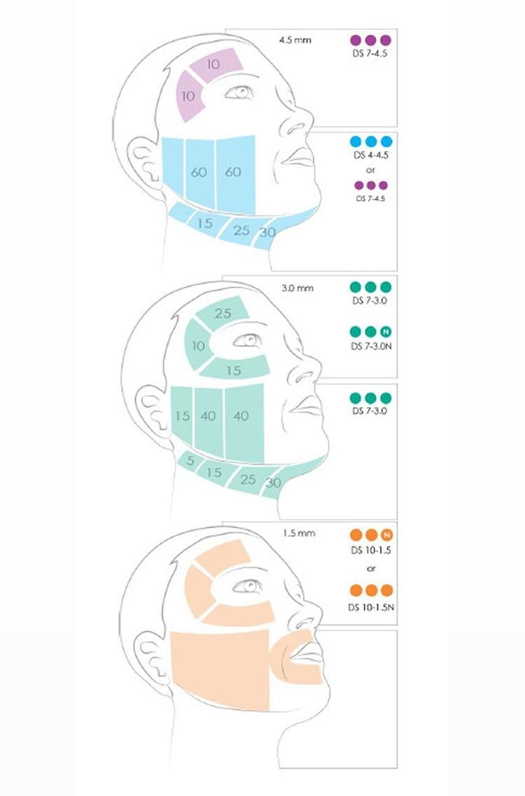 high Intensity Focused Ultrasound Skin Therapy+Vaginal Tightening Machine