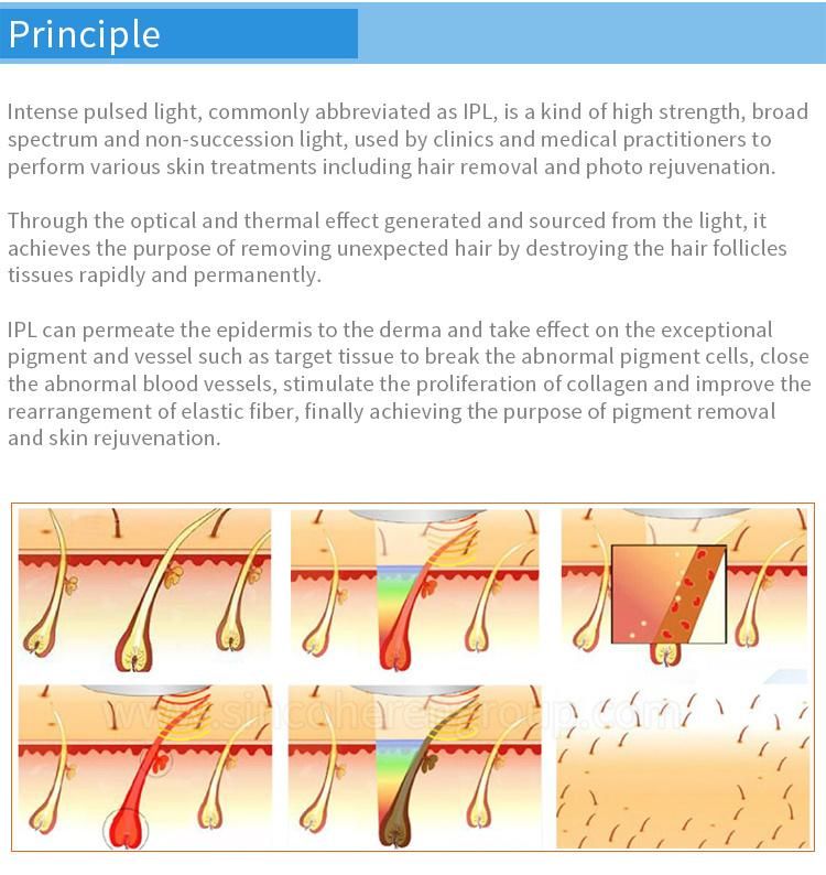 Portable IPL Laser Hair Removal Machine Opt Shr Machines Elight laser Hairs Reduction 300, 000 Shots IPL Laser Machine