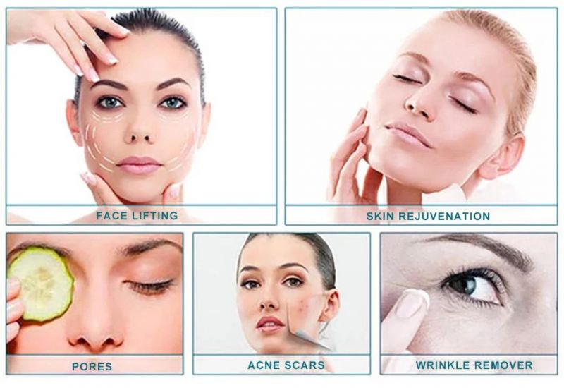 Az RF Micro- Needling Skin Rejuvenation Skin Tightening