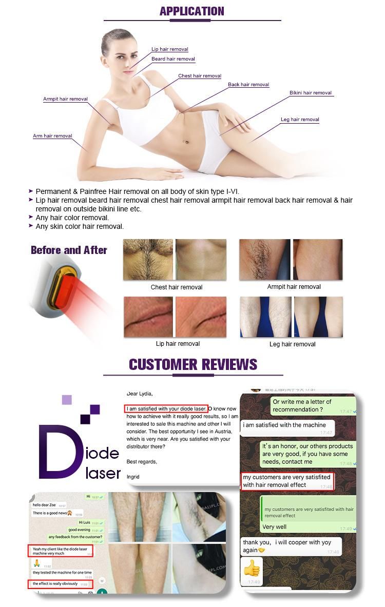 Diode Laser 808nm Soprano Ice Platinum Triple Wavelength 755 808 1064nm Diode Laser Hair Removal Machine Price