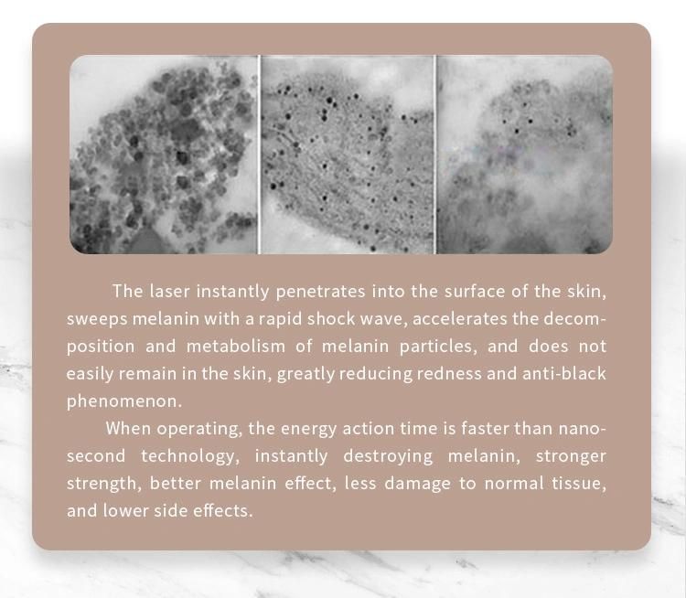 Renlang 1064 532 755 Q Switched ND YAG Laser Tattoo Removal for Spot Acne Scar Removal New Technology