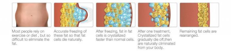 Professional Fat Freezing Beauty Portable Cryolipolysis Fast Slimming Machine