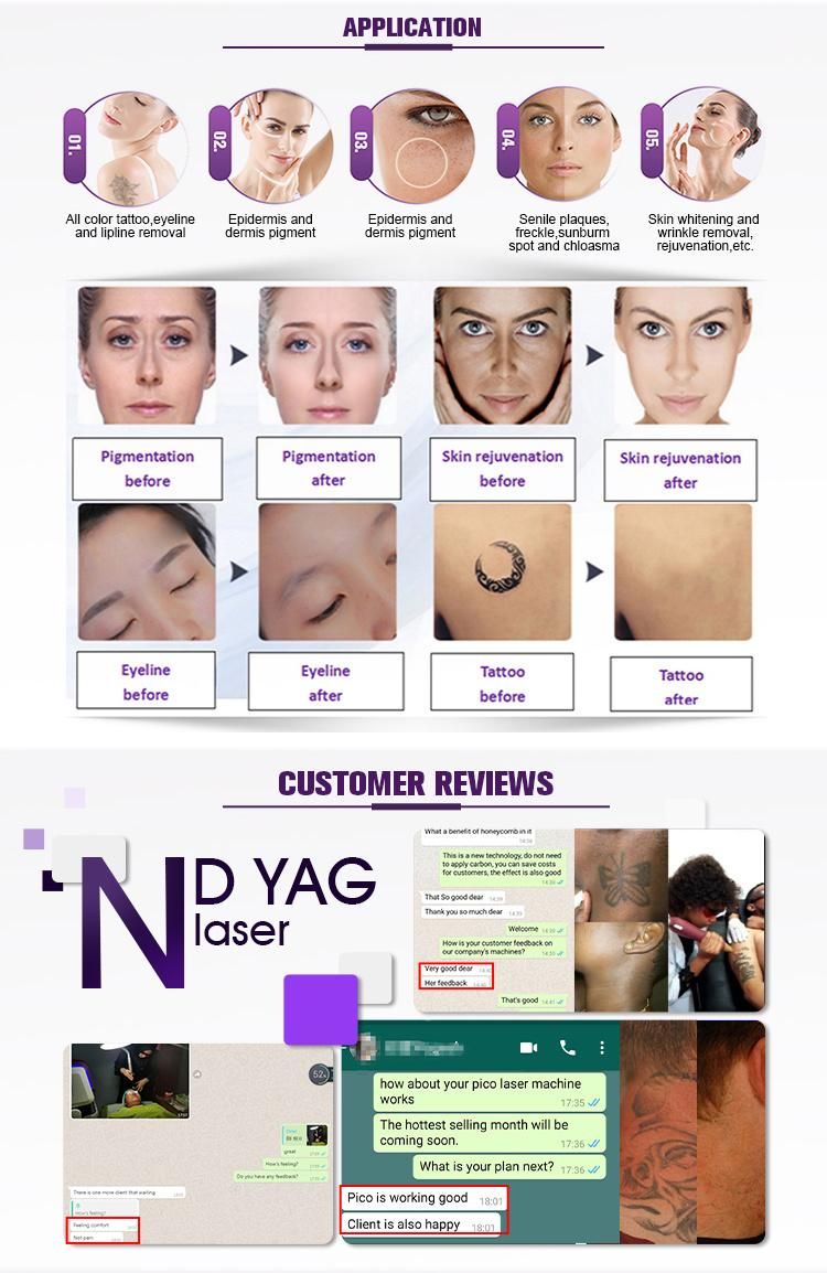 ND YAG Tatto Laser and Pigment Remove Q Switch ND YAG Laser Tattoo Removal 1064 532nm Laser