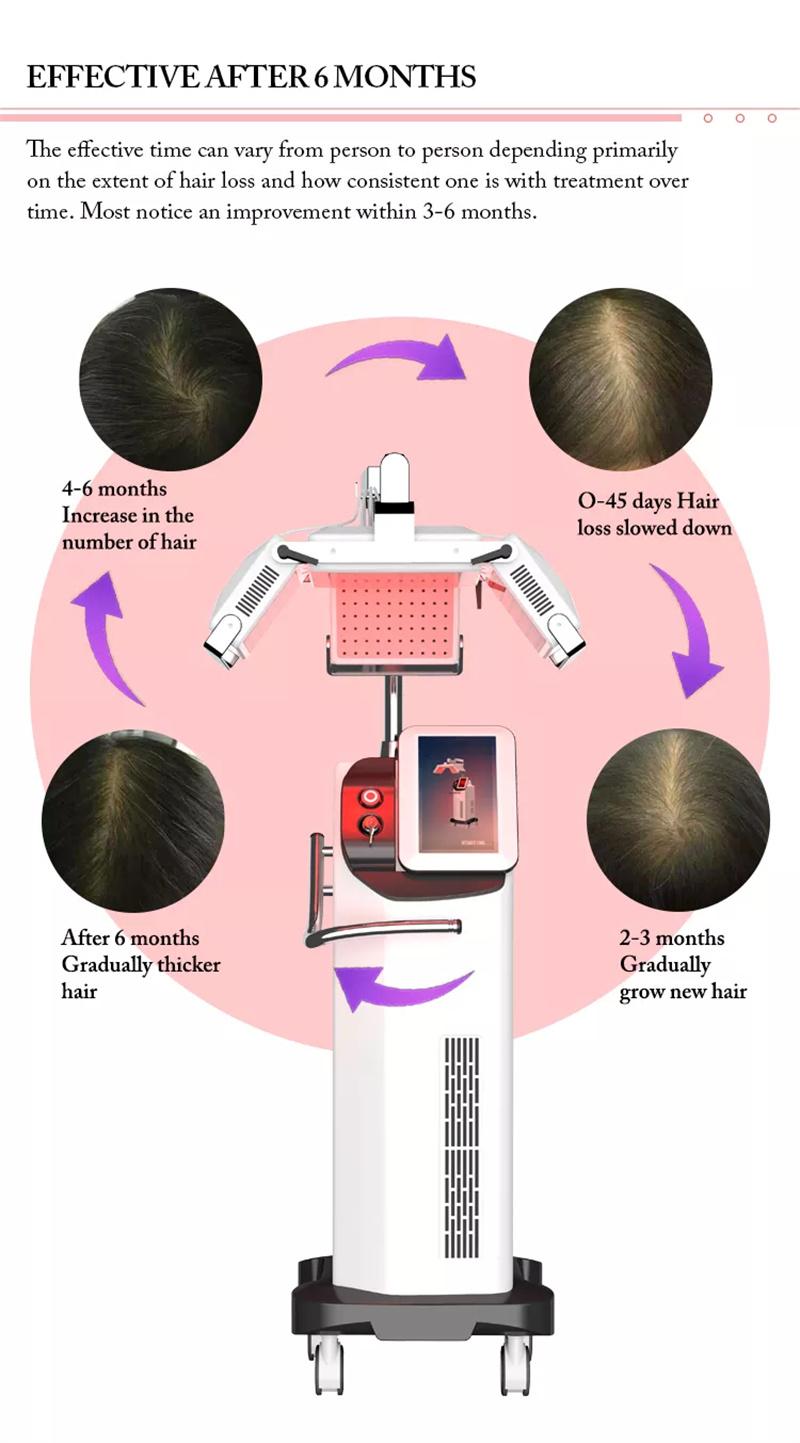Amazon Hot Sale Laser Hair Regrowth Machine LED Light Scalp Stimulator for Hair Growth