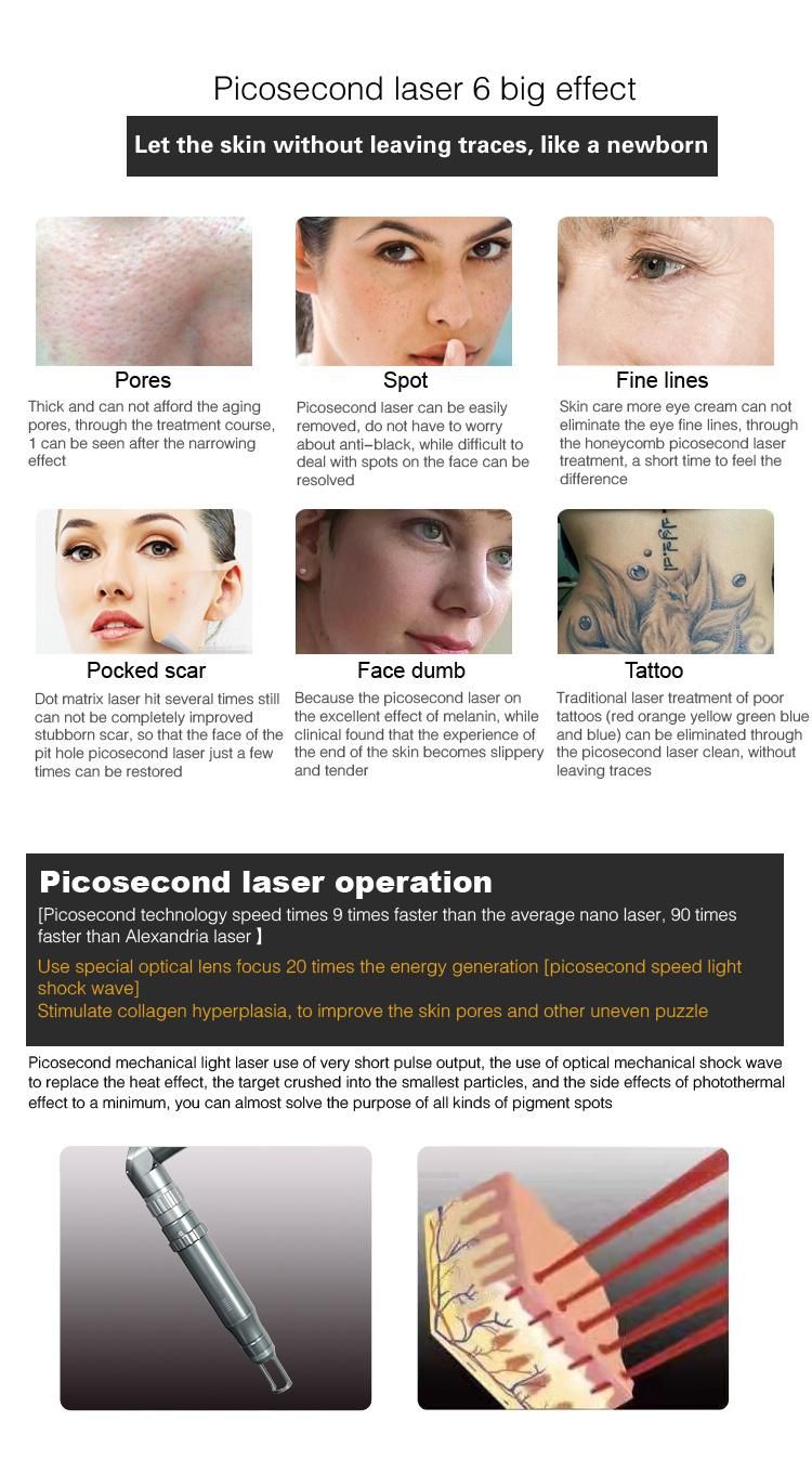 Picosur Picosecond Laser Machine for All Pigment Removal and Tattoo Removal