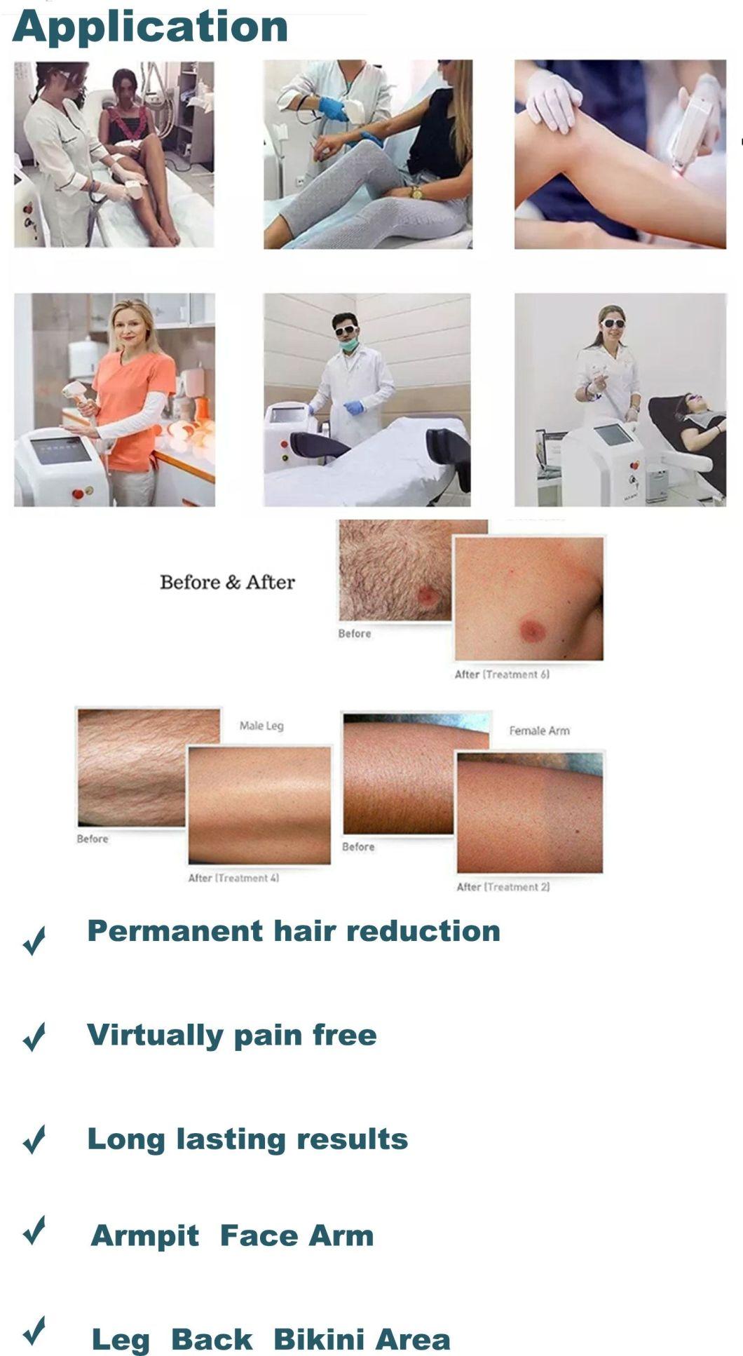 2022 Permanent Laser Hair Removal Diode 755 808 1064 Nm Hair Remover