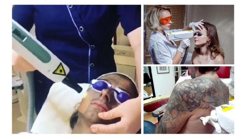 Tattoo Removal Skin Rejuvenation ND YAG Laser Machine