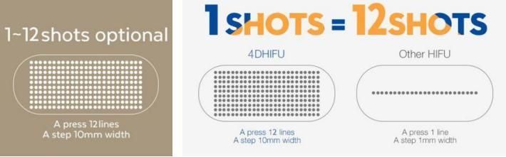 Four Treatment Heads for Multiple Functions 4D Hifu Machine