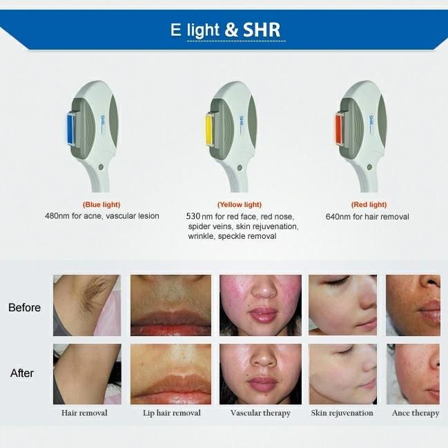 Shr Hair Removal / IPL Wrinkle Removal Beauty Equipment