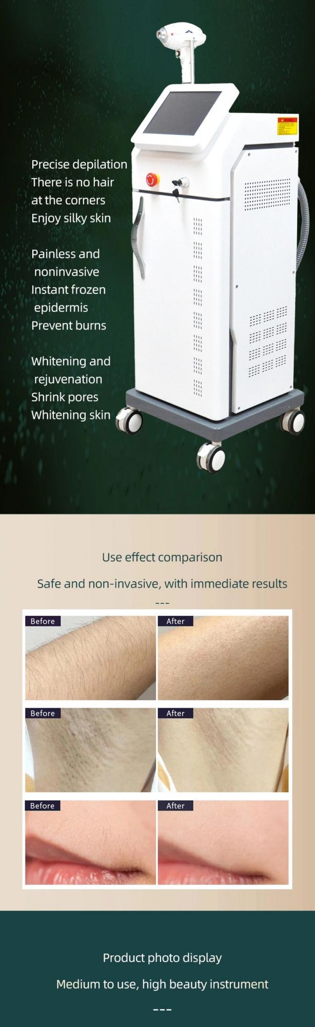 Pain Free New All Skin Types Hair Removal 755nm 808nm 1064nm Machine