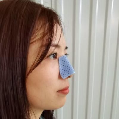 Direct Source Blue Color Nose Splint for Plastic Surgery Rhinoplasty