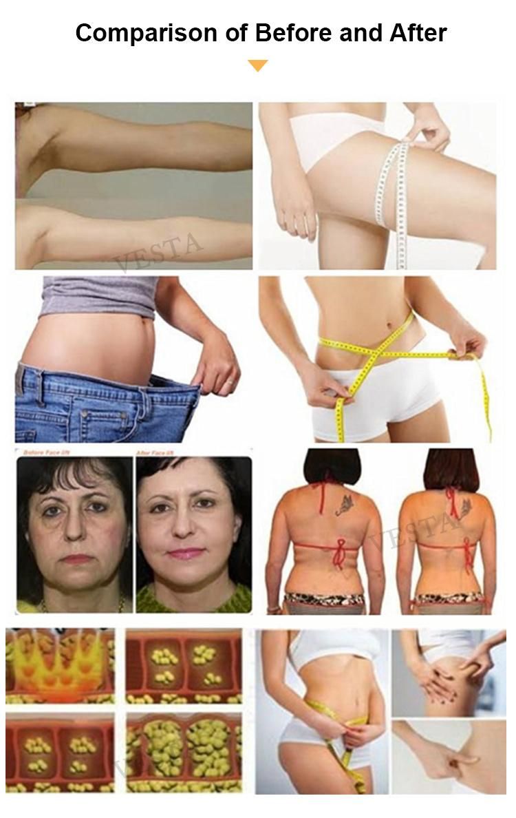 V9 Body Slimming Machine with 40kHz Cavitation Head for Fat Reduction