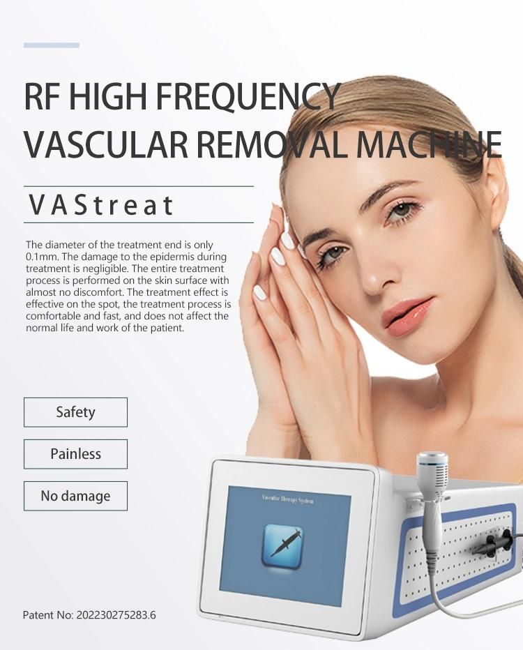 Vastreat High Frequency Vascular Spider Vein Removal Machine RF Beauty Equipment