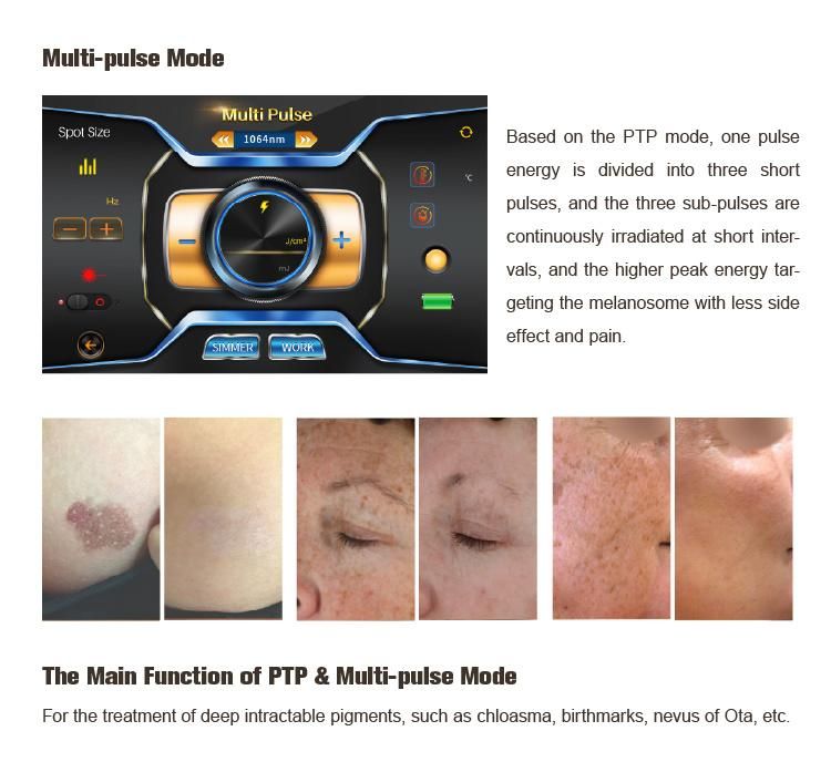 Laser Freckle Removal Permanent Adm Pigmentation Therapy Ce ND YAG Picosecond Laser Machine