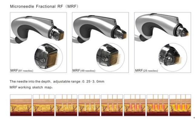 Magical Effect Cryolipolysis Fractional RF Microneedle Beauty Machine (Mr18-2s/CE)