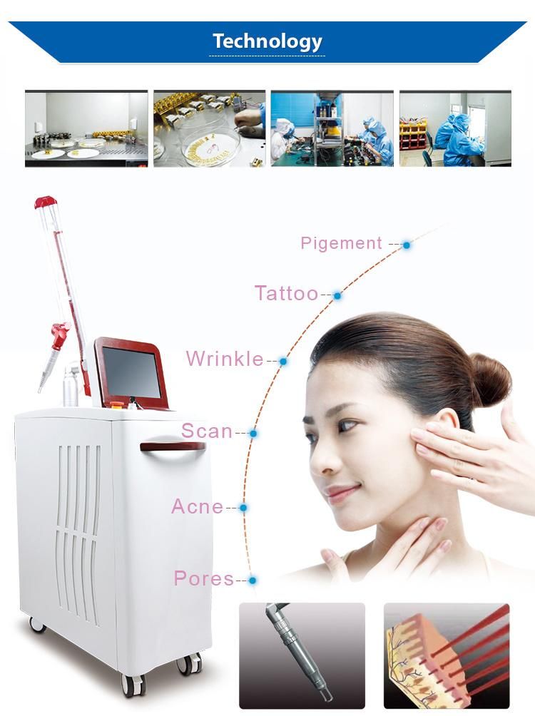 755nm, 1064nm, 532nm ND YAG Laser Tattoo Removal Vertical Machine